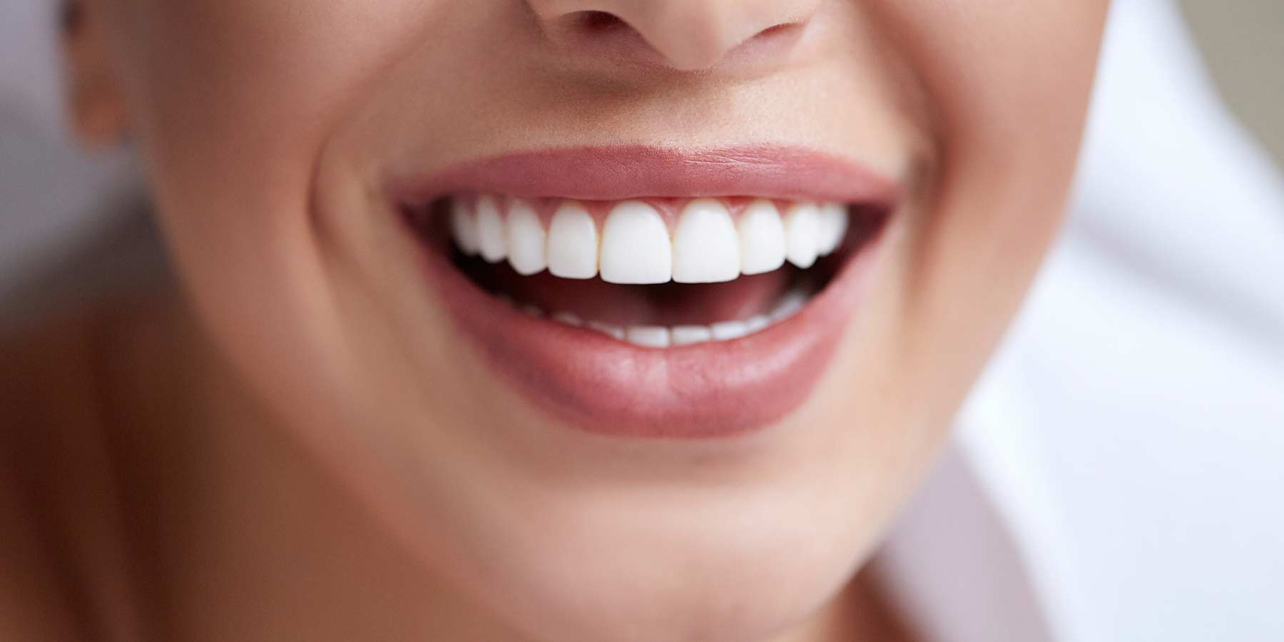 Cosmetic-Dentistry Female patient after Cosmetic dentistry